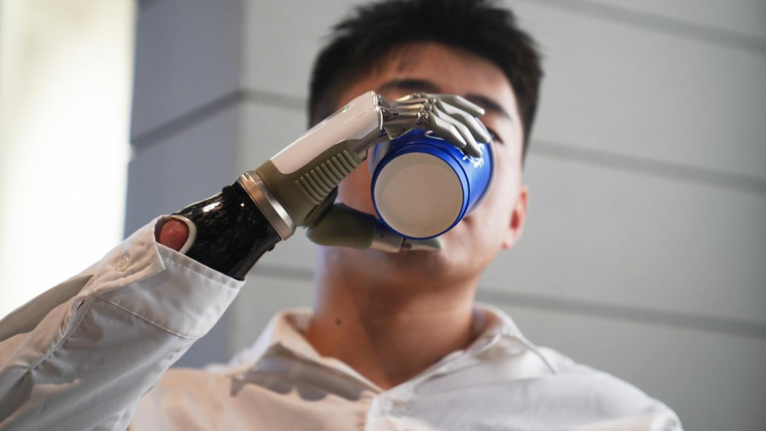Aoyi Technology bionic prosthetic hand product